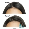 Shampoing Scalp Advanced Anti-Gras 300 ml Shampoing Scalp Advanced Anti-Gras 300 ml