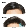 Shampoing Scalp Advanced Anti-Gras 1500 ml - Déstockage Shampoing Scalp Advanced Anti-Gras 1500 ml - Déstockage