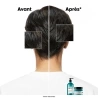 Shampoing Scalp Advanced Anti-Gras 1500 ml Shampoing Scalp Advanced Anti-Gras 1500 ml