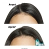 Shampoing Scalp Advanced Anti-Gras 1500 ml Shampoing Scalp Advanced Anti-Gras 1500 ml
