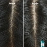 Shampoing Scalp Advanced Anti-pelliculaire 300 ml