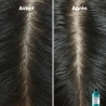 Shampoing Scalp Advanced Anti-pelliculaire 1500 ml Shampoing Scalp Advanced Anti-pelliculaire 1500 ml