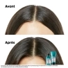Shampoing Scalp Advanced dermo-régulateur apaisant 1500 ml Shampoing Scalp Advanced dermo-régulateur apaisant 1500 ml